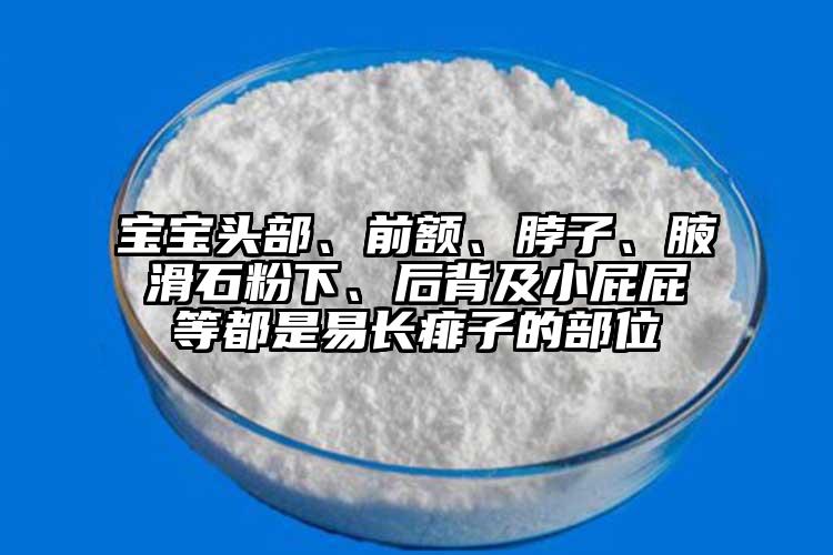 宝宝头部、前额、脖子、腋滑石粉下、后背及小屁屁等都是易长痱子的部位